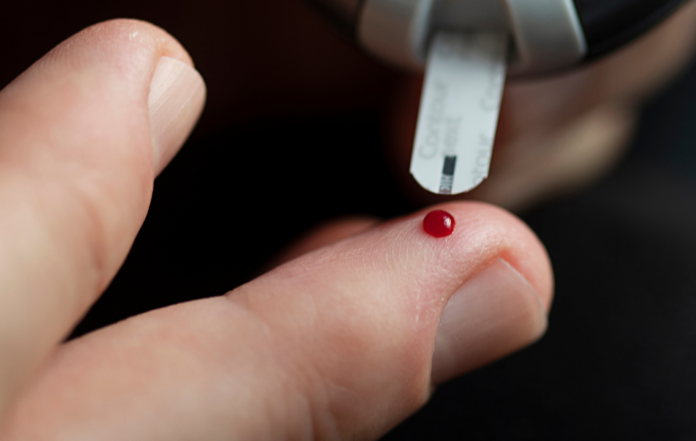 Overlæge sender påmindelser om årlige diabeteskontroller til kvinder i Nordjylland med tidligere graviditetsdiabetes